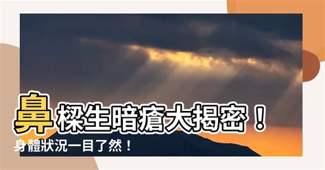 樓梯 鼻樑生暗瘡面相